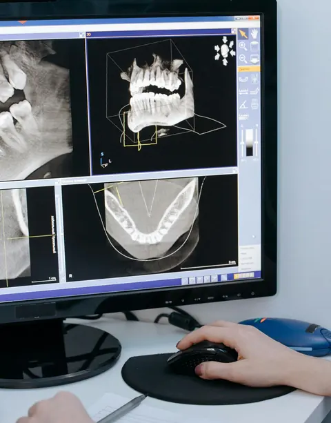 Immagini della TAC 3D sullo schermo dello studio